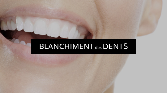 Blanchiment des dents