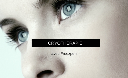 Cryothérapie par Freezpen