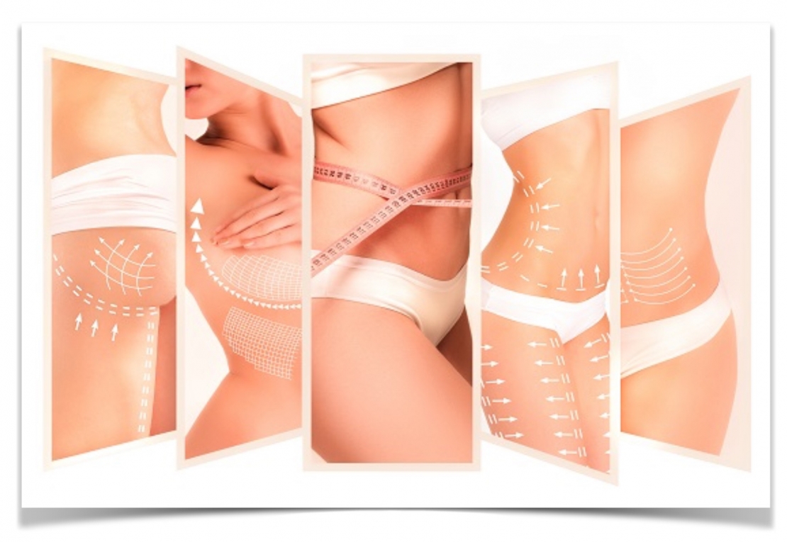 Traitements cellulite avec Velashape